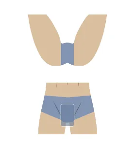 VIO画像