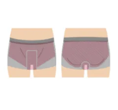 VIO画像