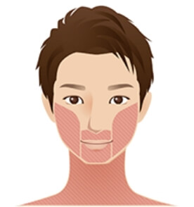 部位イメージ